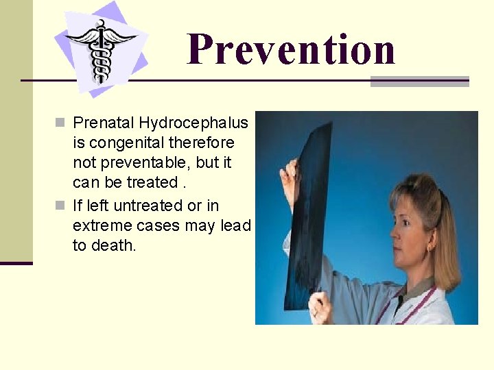 Prevention n Prenatal Hydrocephalus is congenital therefore not preventable, but it can be treated.