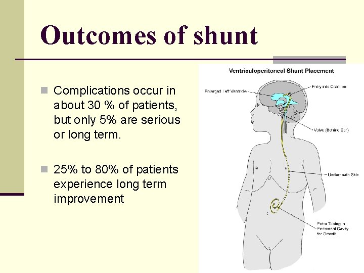 Outcomes of shunt n Complications occur in about 30 % of patients, but only Outcomes of shunt n Complications occur in about 30 % of patients, but only