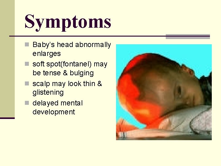 Symptoms n Baby’s head abnormally enlarges n soft spot(fontanel) may be tense & bulging Symptoms n Baby’s head abnormally enlarges n soft spot(fontanel) may be tense & bulging