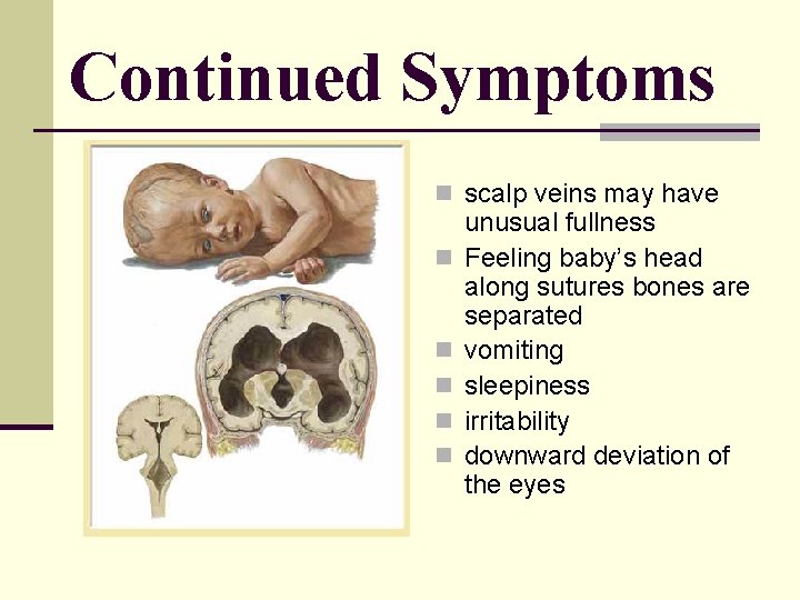 Continued Symptoms n scalp veins may have n n n unusual fullness Feeling baby’s