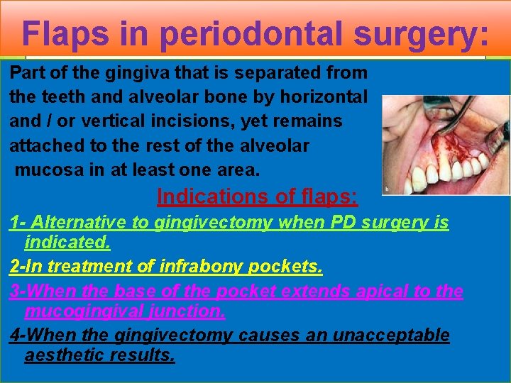 Flaps in periodontal surgery: Part of the gingiva that is separated from the teeth