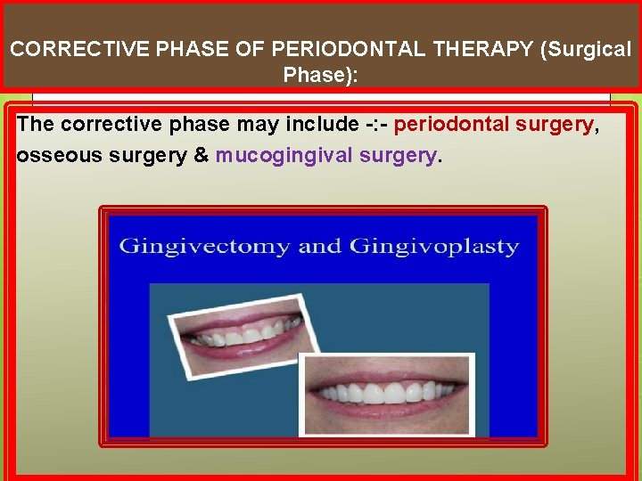 CORRECTIVE PHASE OF PERIODONTAL THERAPY (Surgical Phase): The corrective phase may include -: -