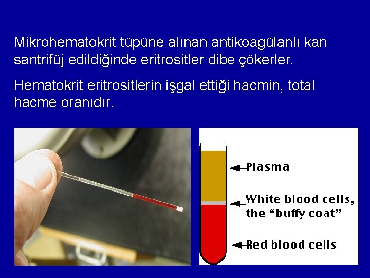 Mikrohematokrit tüpüne alınan antikoagülanlı kan santrifüj edildiğinde eritrositler dibe çökerler. Hematokrit eritrositlerin işgal ettiği Mikrohematokrit tüpüne alınan antikoagülanlı kan santrifüj edildiğinde eritrositler dibe çökerler. Hematokrit eritrositlerin işgal ettiği