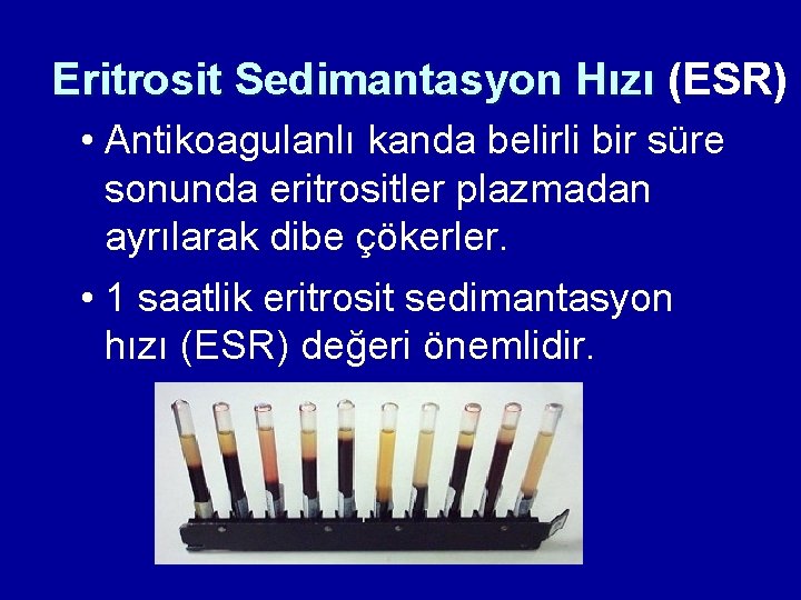 Eritrosit Sedimantasyon Hızı (ESR) • Antikoagulanlı kanda belirli bir süre sonunda eritrositler plazmadan ayrılarak Eritrosit Sedimantasyon Hızı (ESR) • Antikoagulanlı kanda belirli bir süre sonunda eritrositler plazmadan ayrılarak