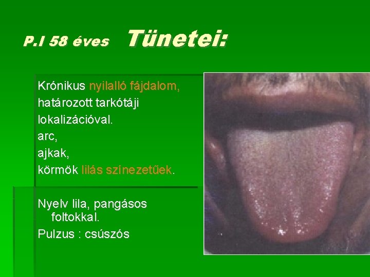 P. I 58 éves Tünetei: Krónikus nyilalló fájdalom, határozott tarkótáji lokalizációval. arc, ajkak, körmök