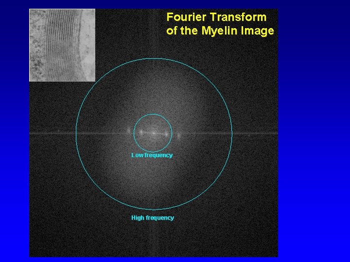 Fourier Transform of the Myelin Image Low frequency High frequency 