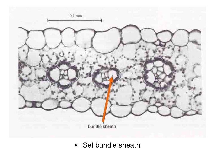  • Sel bundle sheath 