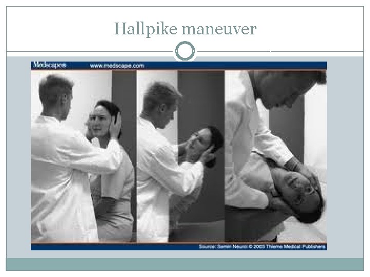 Hallpike maneuver Hallpike maneuver