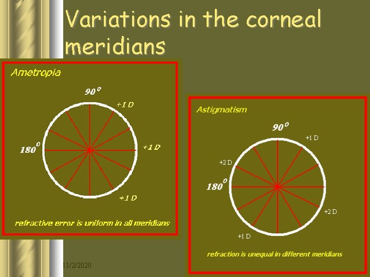 Variations in the corneal meridians +1 D +2 D +1 D 11/2/2020 10 