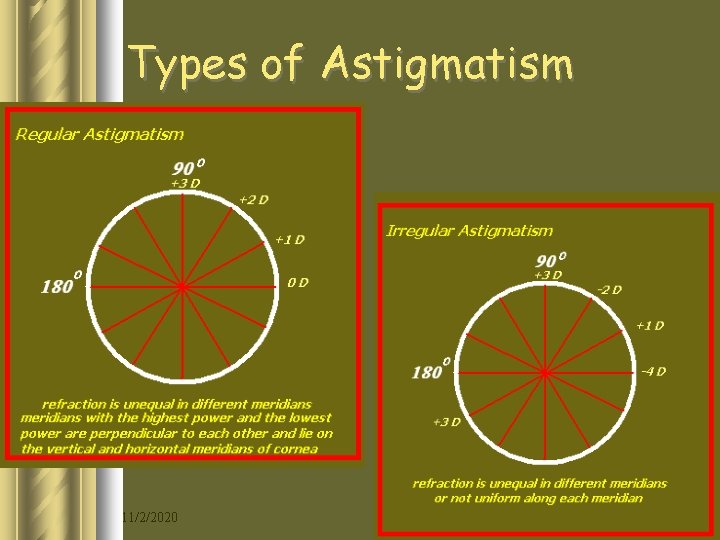 Types of Astigmatism 11/2/2020 11 