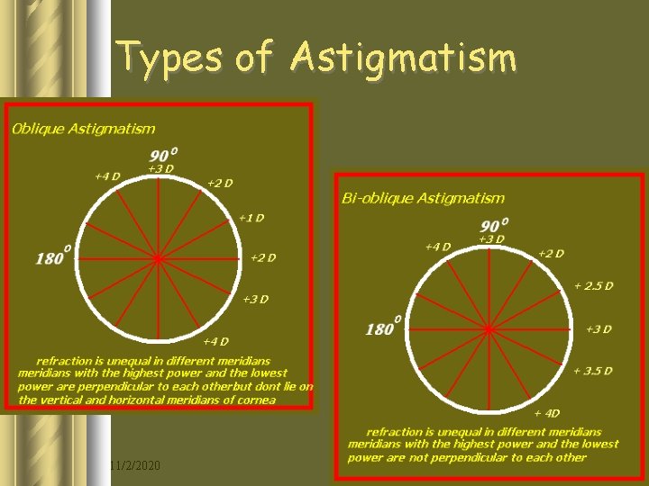 Types of Astigmatism 11/2/2020 12 