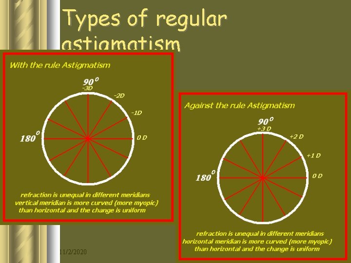 Types of regular astigmatism 11/2/2020 13 