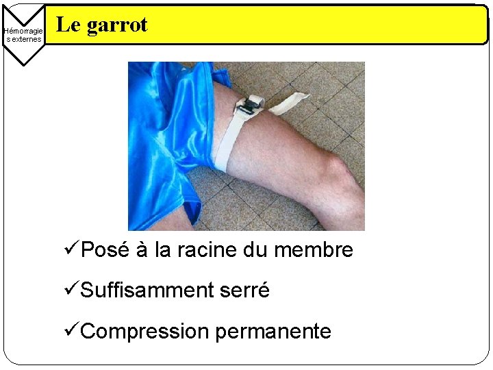 Hémorragie s externes Le garrot üPosé à la racine du membre üSuffisamment serré üCompression