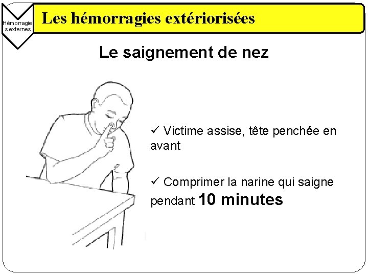Hémorragie s externes Les hémorragies extériorisées Le saignement de nez ü Victime assise, tête
