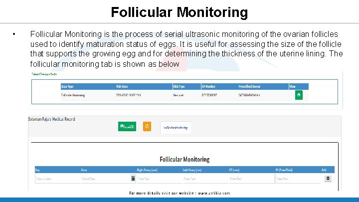Follicular Monitoring • Follicular Monitoring is the process of serial ultrasonic monitoring of the Follicular Monitoring • Follicular Monitoring is the process of serial ultrasonic monitoring of the