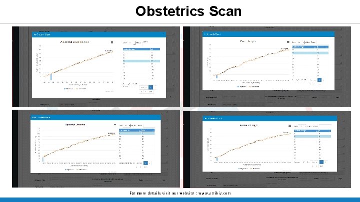 Obstetrics Scan Obstetrics Scan