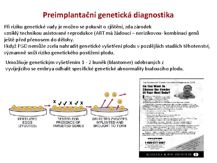 Preimplantační genetická diagnostika Při riziku genetické vady je možno se pokusit o zjištění, zda Preimplantační genetická diagnostika Při riziku genetické vady je možno se pokusit o zjištění, zda