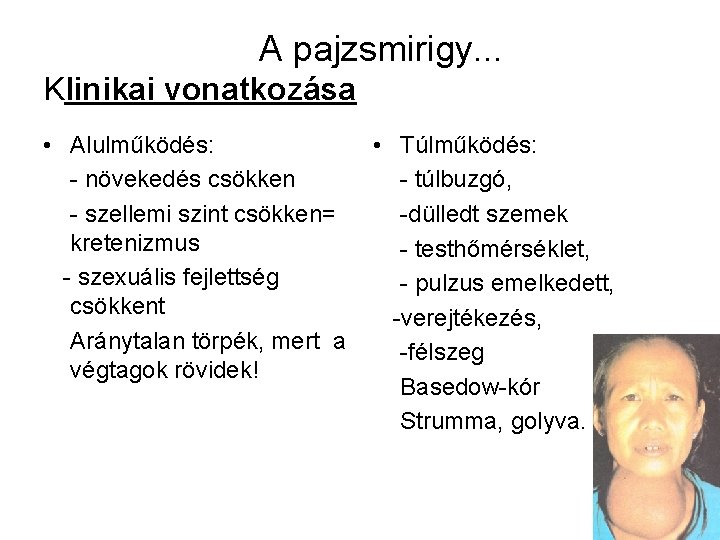 A pajzsmirigy. . . Klinikai vonatkozása • Alulműködés: - növekedés csökken - szellemi szint A pajzsmirigy. . . Klinikai vonatkozása • Alulműködés: - növekedés csökken - szellemi szint