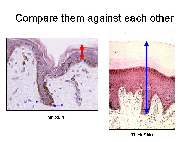 Compare them against each other Thin Skin Thick Skin 