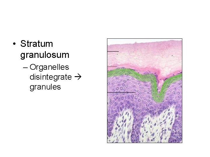  • Stratum granulosum – Organelles disintegrate granules 