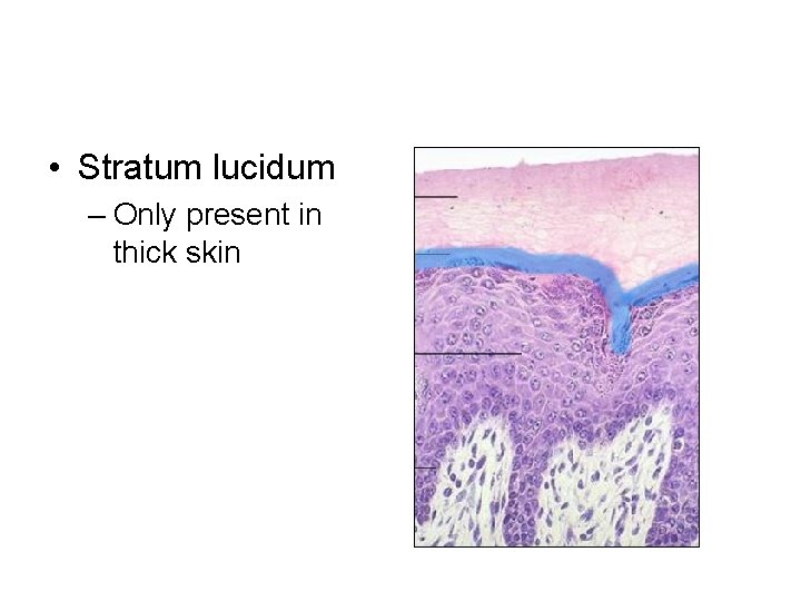  • Stratum lucidum – Only present in thick skin 