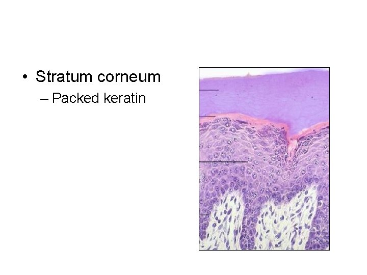  • Stratum corneum – Packed keratin 