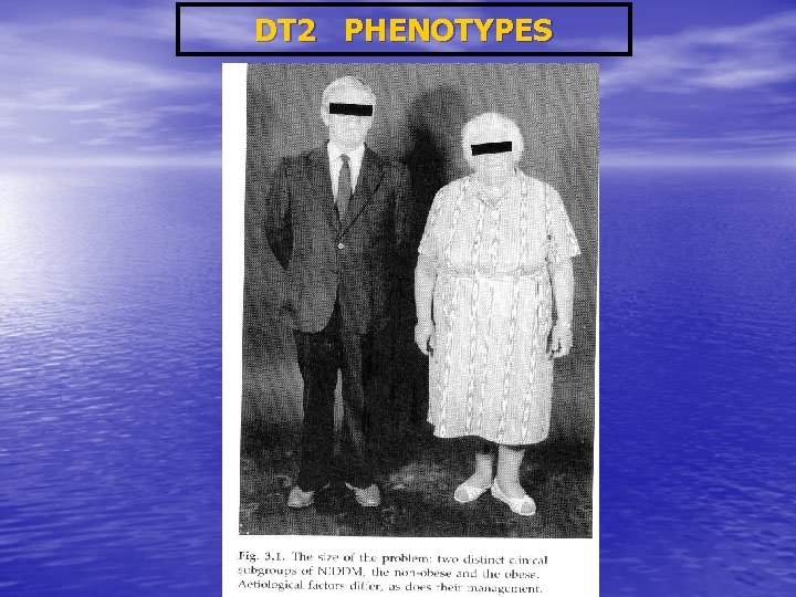 DT 2 PHENOTYPES 