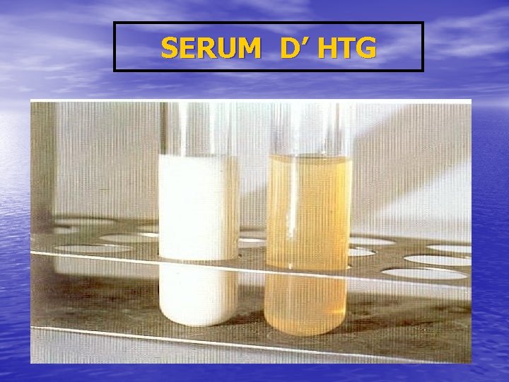 SERUM D’ HTG 