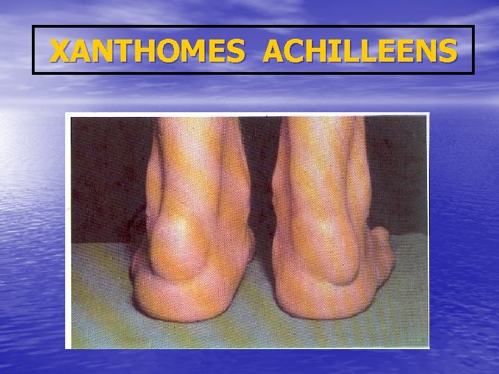 XANTHOMES ACHILLEENS 