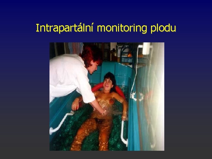 Intrapartální monitoring plodu 