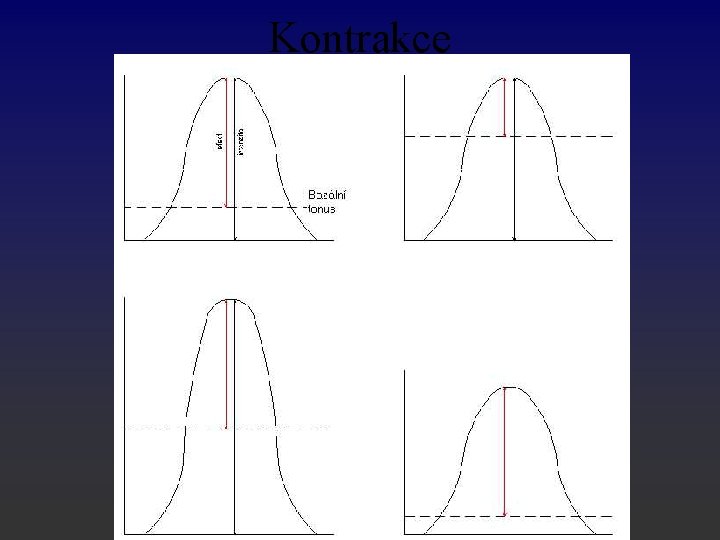 Kontrakce 