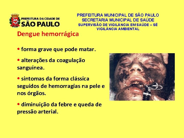 PREFEITURA MUNICIPAL DE SÃO PAULO SECRETARIA MUNICIPAL DE SAÚDE SUPERVISÃO DE VIGIL NCIA EM PREFEITURA MUNICIPAL DE SÃO PAULO SECRETARIA MUNICIPAL DE SAÚDE SUPERVISÃO DE VIGIL NCIA EM