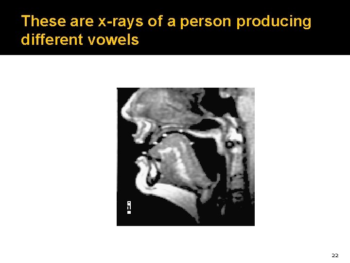 These are x-rays of a person producing different vowels 22 