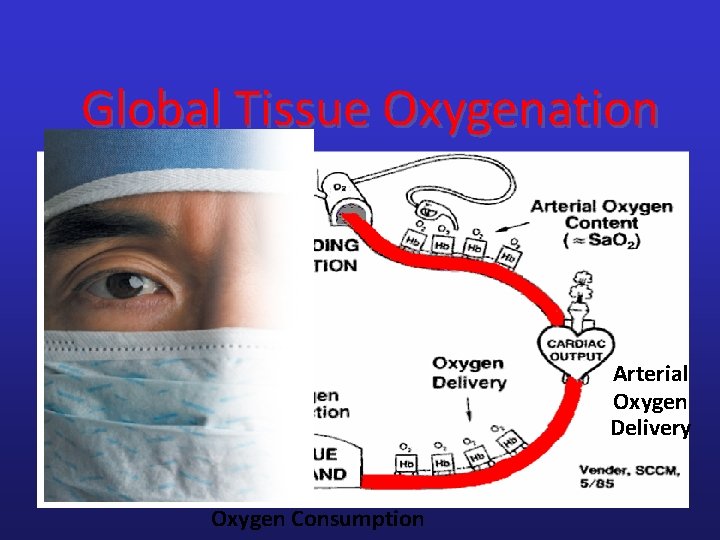 Global Tissue Oxygenation Venous Oxygen Delivery Arterial Oxygen Delivery Oxygen Consumption Global Tissue Oxygenation Venous Oxygen Delivery Arterial Oxygen Delivery Oxygen Consumption