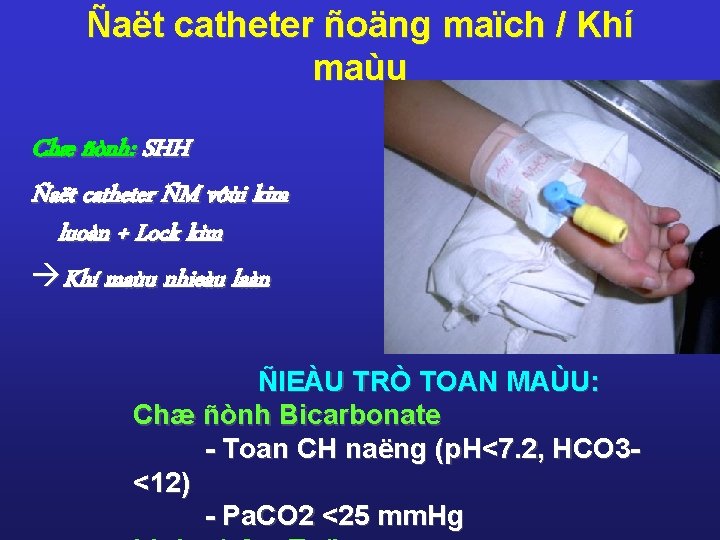 Ñaët catheter ñoäng maïch / Khí maùu Chæ ñònh: SHH Ñaët catheter ÑM vôùi