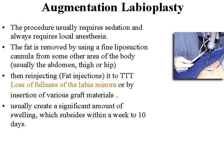 Augmentation Labioplasty • The procedure usually requires sedation and always requires local anesthesia. •