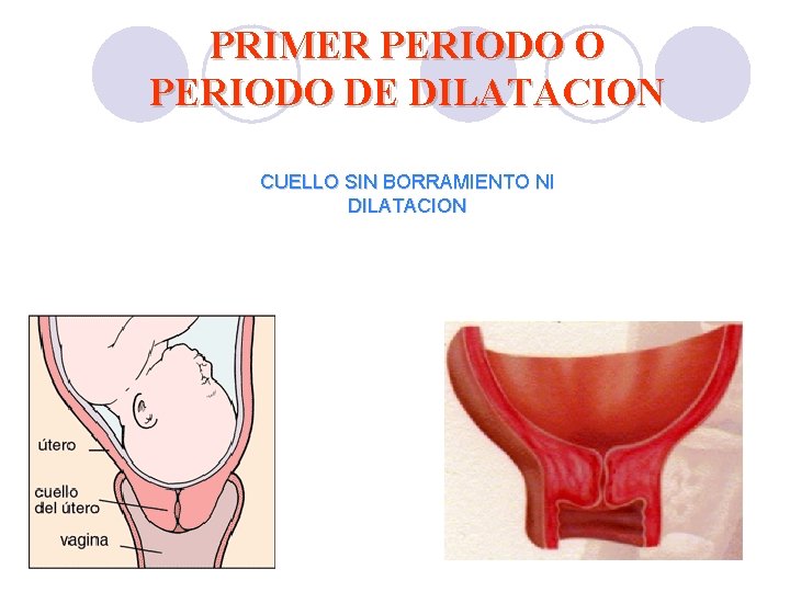 PRIMER PERIODO O PERIODO DE DILATACION CUELLO SIN BORRAMIENTO NI DILATACION PRIMER PERIODO O PERIODO DE DILATACION CUELLO SIN BORRAMIENTO NI DILATACION