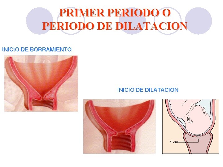 PRIMER PERIODO O PERIODO DE DILATACION INICIO DE BORRAMIENTO INICIO DE DILATACION PRIMER PERIODO O PERIODO DE DILATACION INICIO DE BORRAMIENTO INICIO DE DILATACION