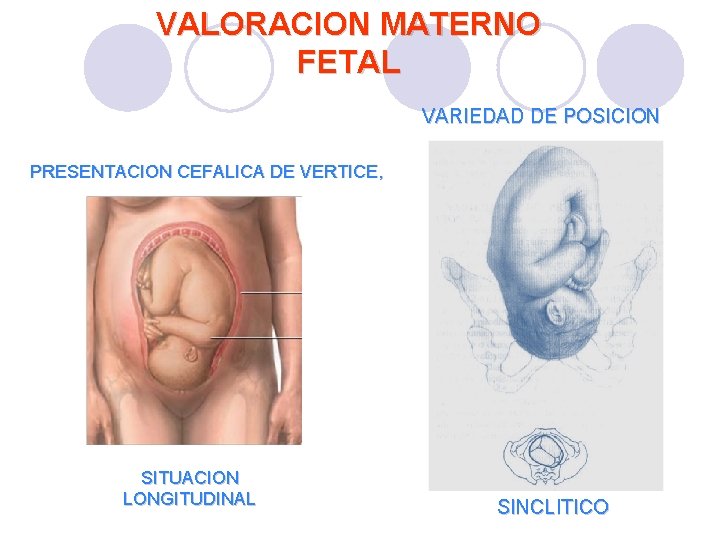 VALORACION MATERNO FETAL VARIEDAD DE POSICION PRESENTACION CEFALICA DE VERTICE, SITUACION LONGITUDINAL SINCLITICO VALORACION MATERNO FETAL VARIEDAD DE POSICION PRESENTACION CEFALICA DE VERTICE, SITUACION LONGITUDINAL SINCLITICO