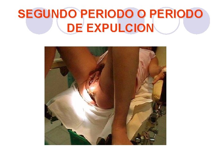 SEGUNDO PERIODO DE EXPULCION SEGUNDO PERIODO DE EXPULCION