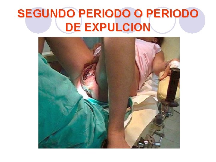 SEGUNDO PERIODO DE EXPULCION SEGUNDO PERIODO DE EXPULCION