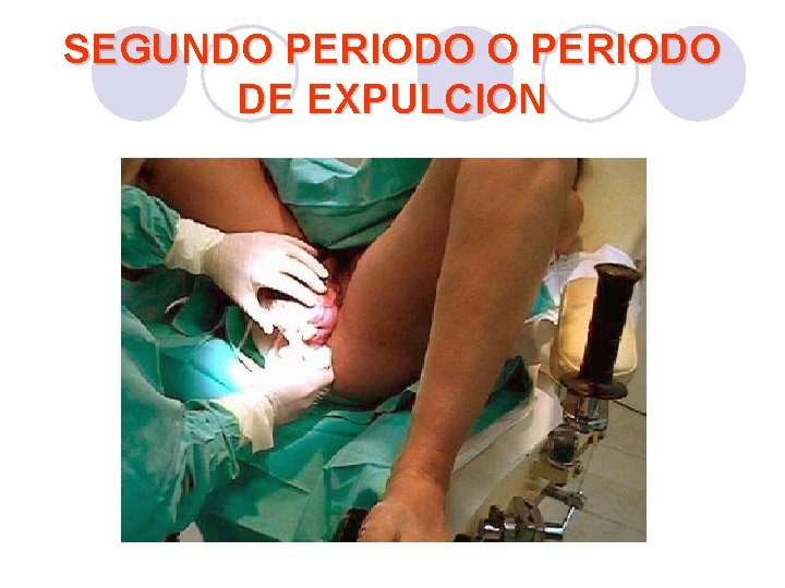 SEGUNDO PERIODO DE EXPULCION SEGUNDO PERIODO DE EXPULCION