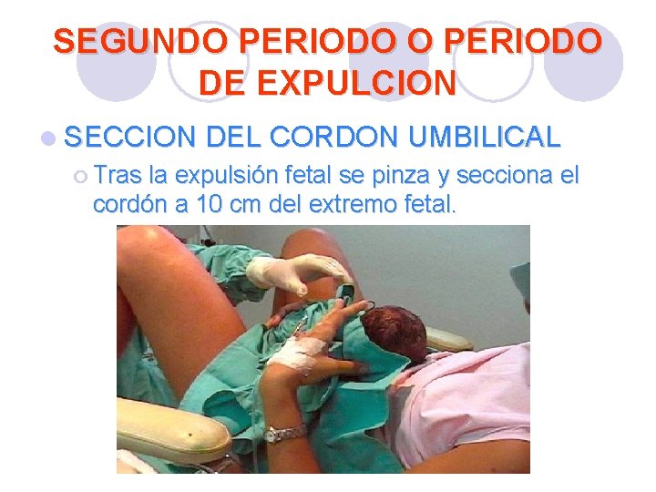SEGUNDO PERIODO DE EXPULCION l SECCION DEL CORDON UMBILICAL ¡ Tras la expulsión fetal SEGUNDO PERIODO DE EXPULCION l SECCION DEL CORDON UMBILICAL ¡ Tras la expulsión fetal