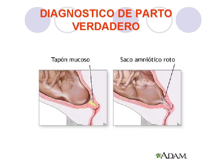 DIAGNOSTICO DE PARTO VERDADERO DIAGNOSTICO DE PARTO VERDADERO