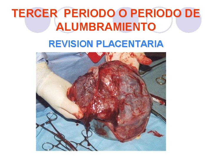TERCER PERIODO O PERIODO DE ALUMBRAMIENTO REVISION PLACENTARIA TERCER PERIODO O PERIODO DE ALUMBRAMIENTO REVISION PLACENTARIA