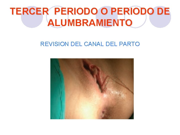 TERCER PERIODO O PERIODO DE ALUMBRAMIENTO REVISION DEL CANAL DEL PARTO TERCER PERIODO O PERIODO DE ALUMBRAMIENTO REVISION DEL CANAL DEL PARTO