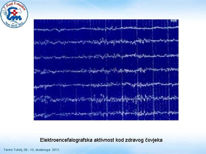 Elektroencefalografska aktivnost kod zdravog čovjeka Terme Tuhelj, 08. - 10. studenoga 2013. Elektroencefalografska aktivnost kod zdravog čovjeka Terme Tuhelj, 08. - 10. studenoga 2013.