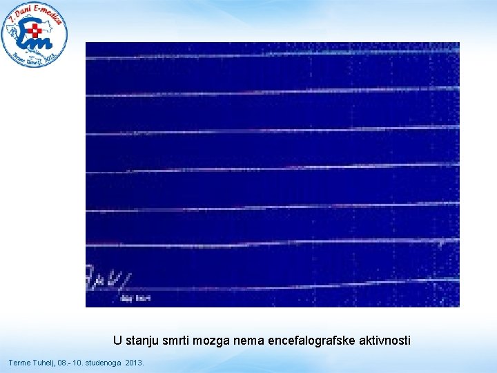 U stanju smrti mozga nema encefalografske aktivnosti Terme Tuhelj, 08. - 10. studenoga 2013. U stanju smrti mozga nema encefalografske aktivnosti Terme Tuhelj, 08. - 10. studenoga 2013.