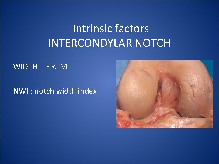  Intrinsic factors INTERCONDYLAR NOTCH WIDTH F < M NWI : notch width index