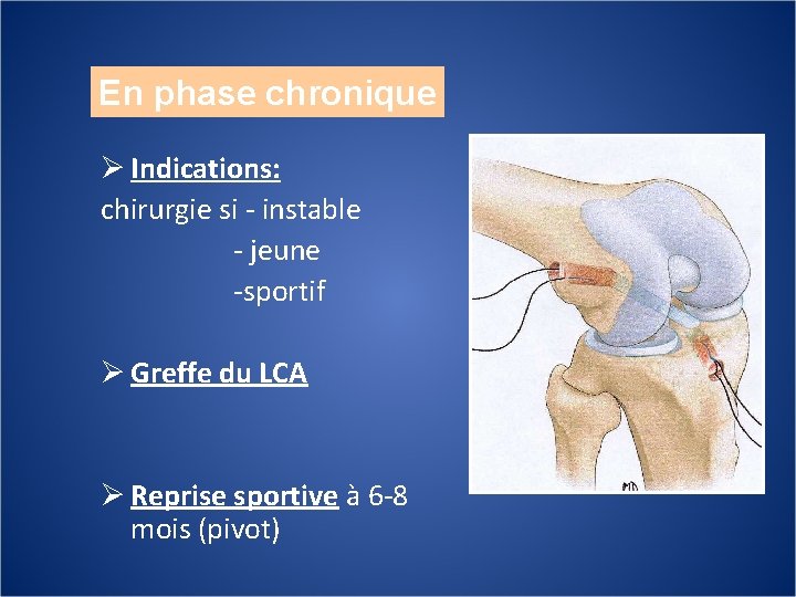 En phase chronique Ø Indications: chirurgie si - instable - jeune -sportif Ø Greffe